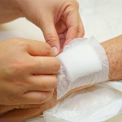 Advanced Wound Dressings 